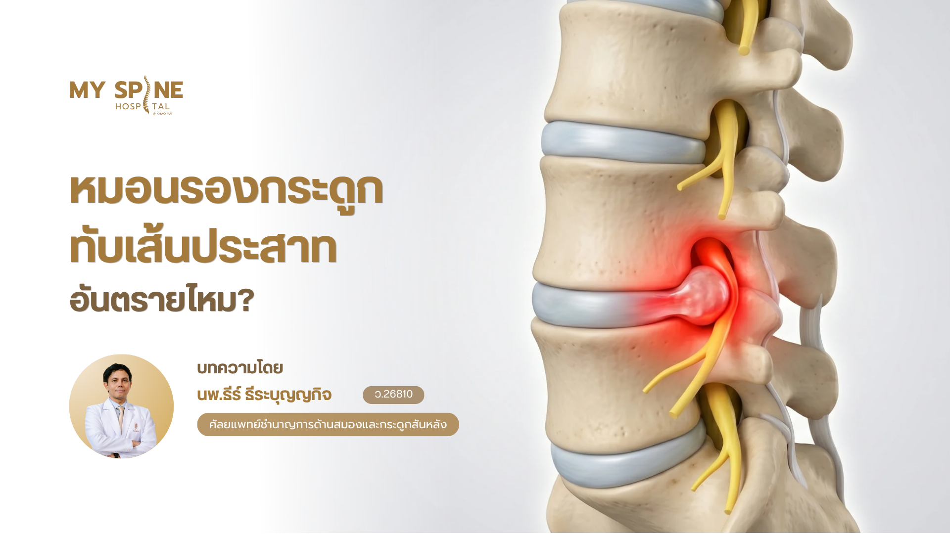 หมอนรองกระดูกทับเส้นประสาทอันตรายไหม? รู้สัญญาณก่อนสาย