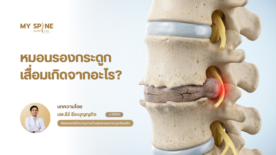 หมอนรองกระดูกเสื่อมเกิดจากอะไร? รู้สาเหตุก่อนลุกลาม