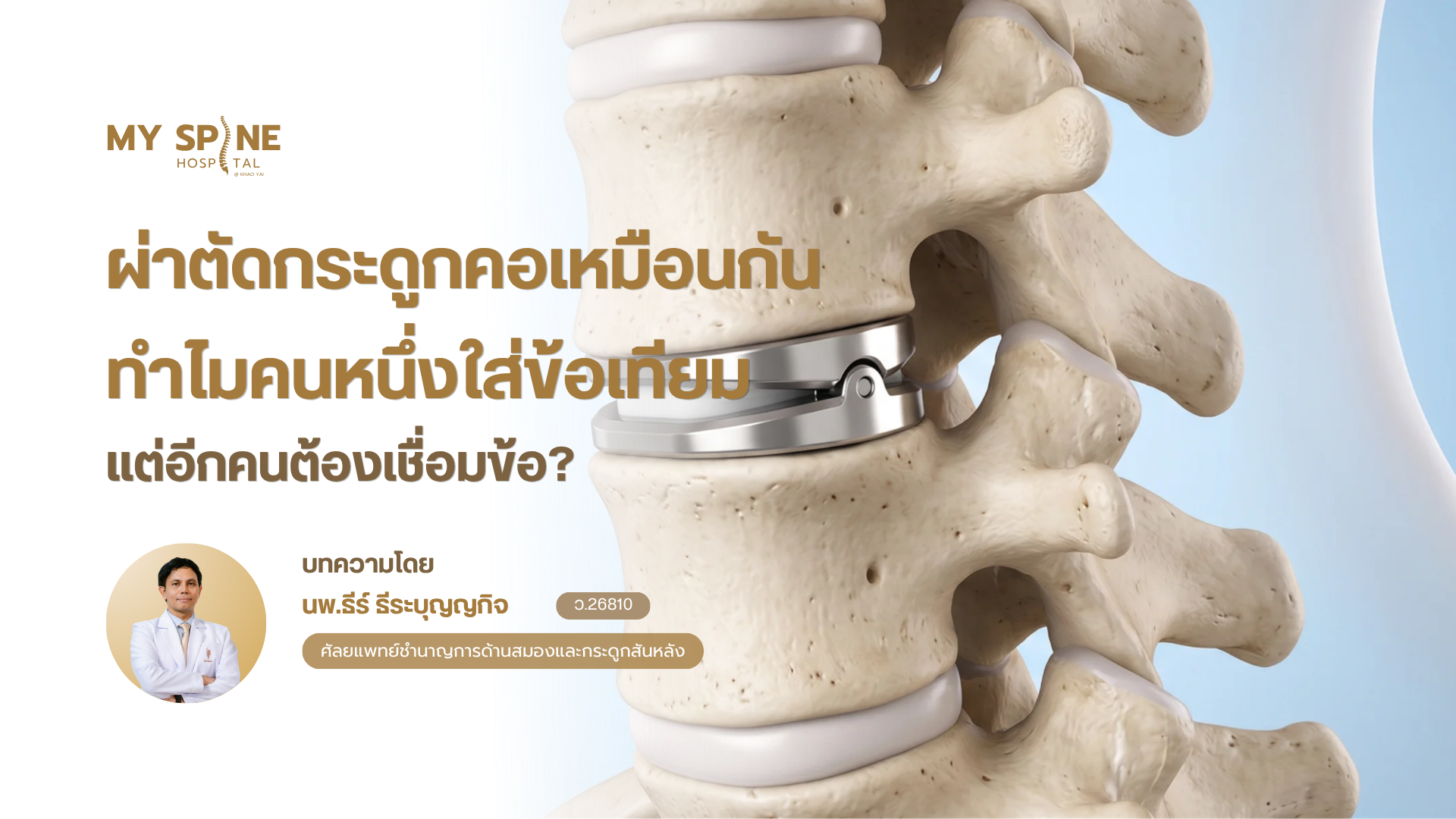  ผ่าตัดกระดูกคอเหมือนกัน ทำไมบางคนใส่ข้อเทียม (TDR) แต่บางคนต้องเชื่อมข้อ (ACDF)? 